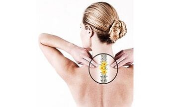 cervical osteochondrosis an enger Fra