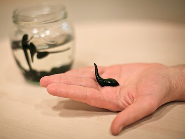 Applikatioun fir d'Behandlung vun Arthrosis vum Kniegelenk