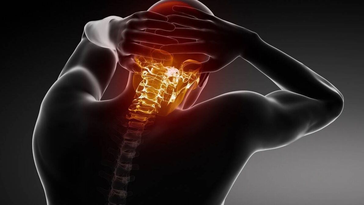 Symptomer vun cervical osteochondrosis